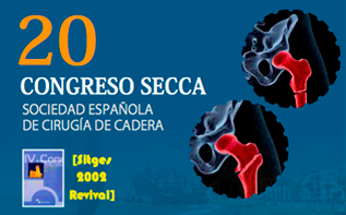 Premio mejor cartel científico presentado en el Congreso de la Sociedad Española de Cadera 2018